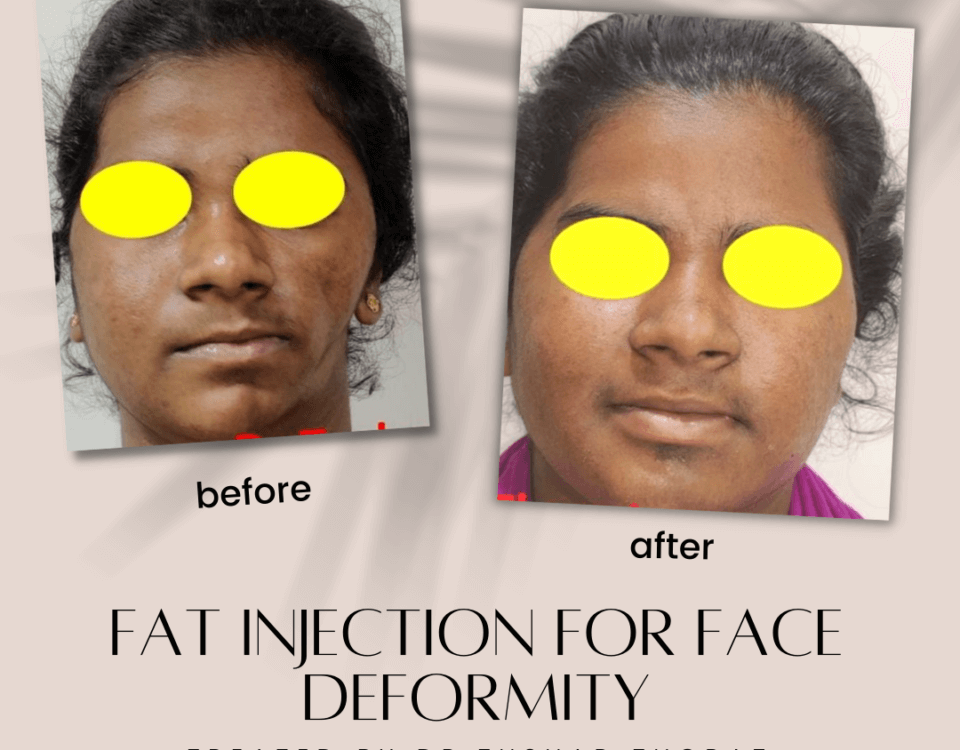 Face Deformity Surgery in Mumbai