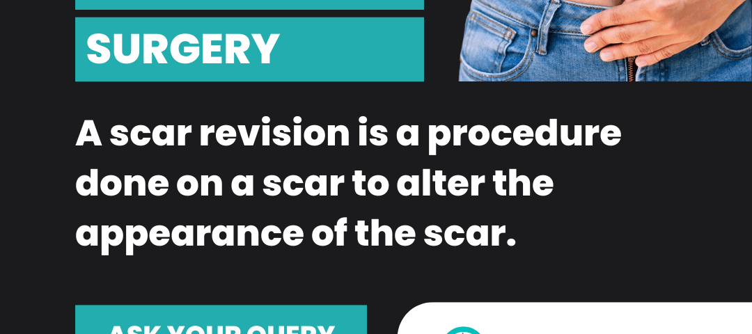 what-is-scar-revision-surgery