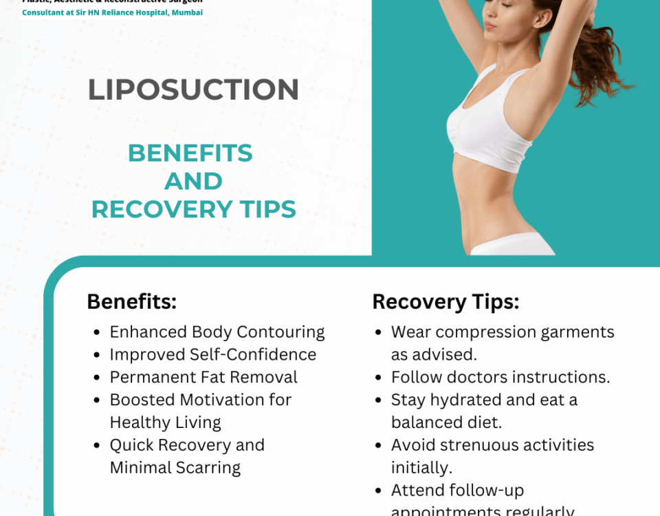 Liposuction